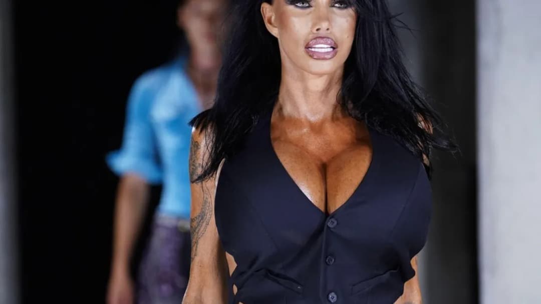 Slika uz članak: Operacija za operacijom: Mnogi će se šokirati kada vide kako se mijenjao izgled Katie Price