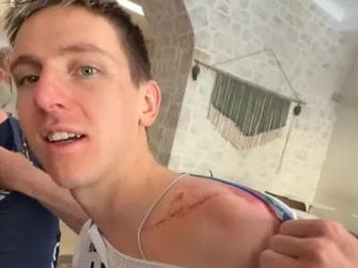 Slika uz članak: Pogačar že trenira na cesti, pa nasmejan kaže brazgotine po operaciji