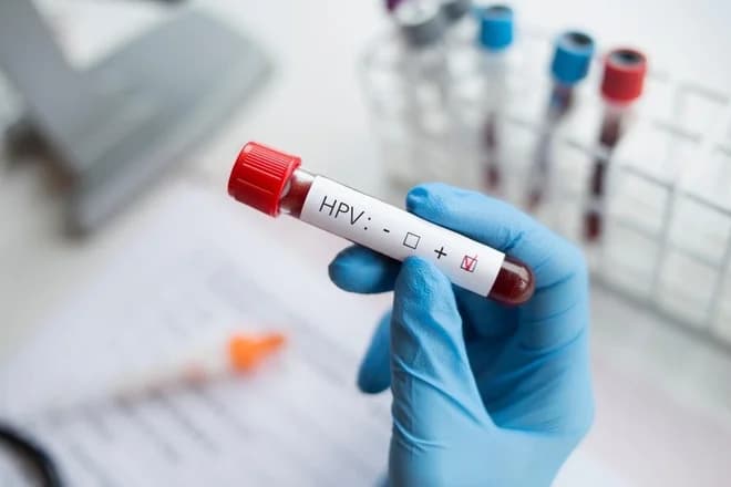 Slika uz članak: Državni program Zora bo uvedel sodobnejši test HPV